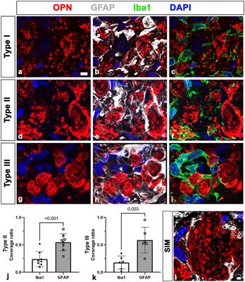 Astrocytes are involved in the formation of corpora amylacea-like structures from neuronal debris in the CA1 region of the rat hippocampus after ischemia